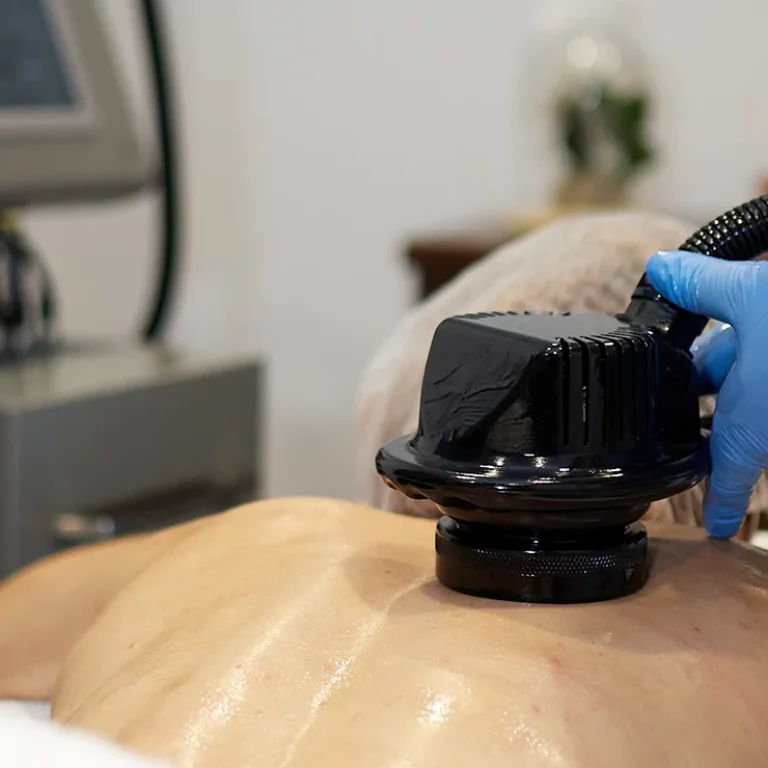 tratamientos-reafirmantes-plasencia-centro-estetica-esperanza-1